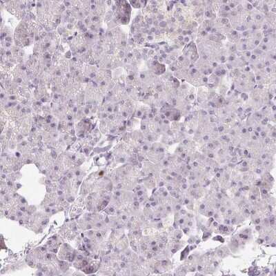 Immunohistochemistry-Paraffin: Importin alpha 2/KPNA2 Antibody [NBP2-38482]