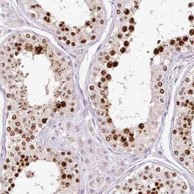 Immunohistochemistry-Paraffin: Importin alpha 2/KPNA2 Antibody [NBP2-38482]