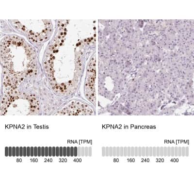 Immunohistochemistry-Paraffin: Importin alpha 2/KPNA2 Antibody [NBP2-38482]