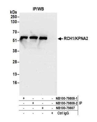 Immunoprecipitation: Importin alpha 2/KPNA2 Antibody [NB100-79808]