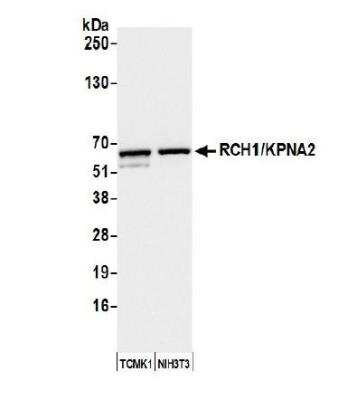 Western Blot: Importin alpha 2/KPNA2 Antibody [NB100-79808]