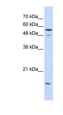 Western Blot: Importin alpha 2/KPNA2 Antibody [NBP1-58067]