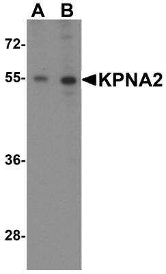 Western Blot: Importin alpha 2/KPNA2 AntibodyBSA Free [NBP1-76298]