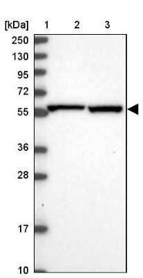 Western Blot: Importin alpha 2/KPNA2 Antibody [NBP2-38482]