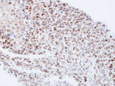 Immunohistochemistry-Paraffin: Importin alpha 3/KPNA4 Antibody [NBP1-31260]