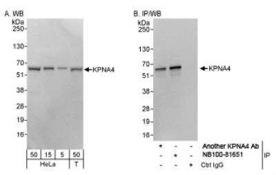 Western Blot: Importin alpha 3/KPNA4 Antibody [NB100-81651]