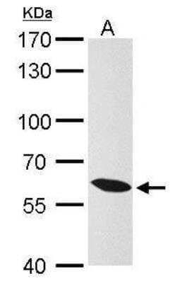 Western Blot: Importin alpha 3/KPNA4 Antibody [NBP1-31260]