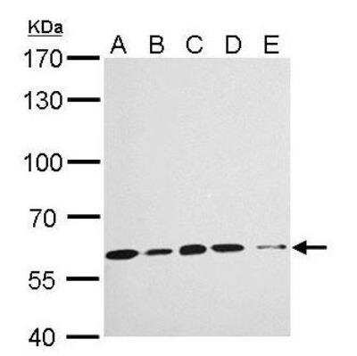 Western Blot: Importin alpha 3/KPNA4 Antibody [NBP1-31260]
