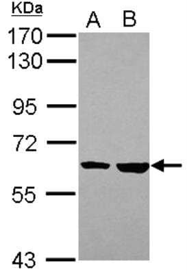 Western Blot: Importin alpha 3/KPNA4 Antibody [NBP1-31260]