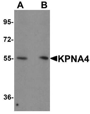 Western Blot: Importin alpha 3/KPNA4 AntibodyBSA Free [NBP1-76300]