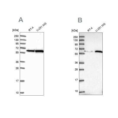 Western Blot: Importin alpha 3/KPNA4 Antibody [NBP2-14173]