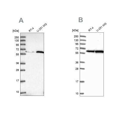 Western Blot: Importin alpha 3/KPNA4 Antibody [NBP2-38541]