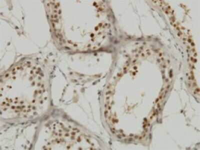 Immunohistochemistry-Paraffin: Importin alpha 5/KPNA1/SRP1 Antibody (2A4-1B5) [H00003836-M01]