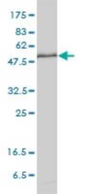 Western Blot: Importin alpha 5/KPNA1/SRP1 Antibody (2A4-1B5) [H00003836-M01]