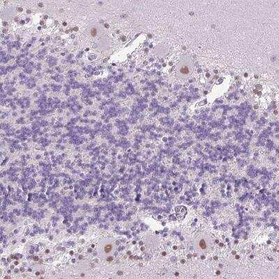 Immunohistochemistry-Paraffin: Importin alpha 5/KPNA1/SRP1 Antibody [NBP2-47418]