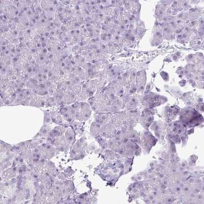 Immunohistochemistry-Paraffin: Importin alpha 5/KPNA1/SRP1 Antibody [NBP2-47418]