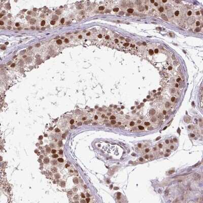 Immunohistochemistry-Paraffin: Importin alpha 5/KPNA1/SRP1 Antibody [NBP2-47418]