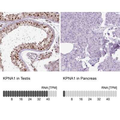 Immunohistochemistry-Paraffin: Importin alpha 5/KPNA1/SRP1 Antibody [NBP2-47418]