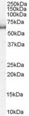 Western Blot: Importin alpha 5/KPNA1/SRP1 Antibody [NB100-1370]