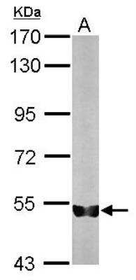 Western Blot: Importin alpha 5/KPNA1/SRP1 Antibody [NBP1-33508]