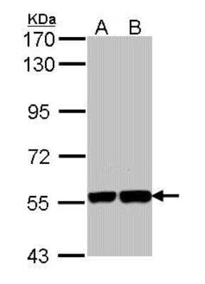 Western Blot: Importin alpha 5/KPNA1/SRP1 Antibody [NBP1-33508]