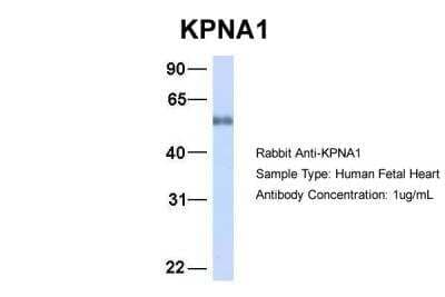 Western Blot: Importin alpha 5/KPNA1/SRP1 Antibody [NBP1-54603]