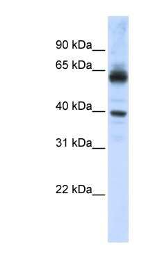 Western Blot: Importin alpha 5/KPNA1/SRP1 Antibody [NBP1-54604]