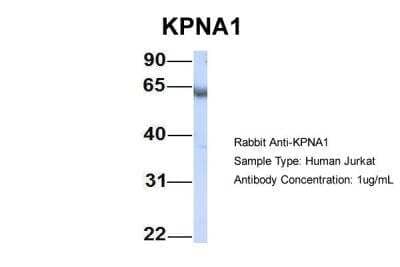 Western Blot: Importin alpha 5/KPNA1/SRP1 Antibody [NBP1-54604]