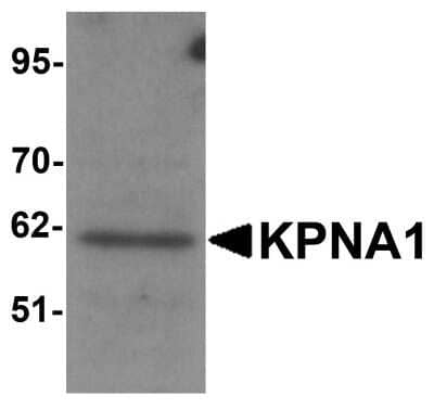 Western Blot: Importin alpha 5/KPNA1/SRP1 AntibodyBSA Free [NBP1-76297]