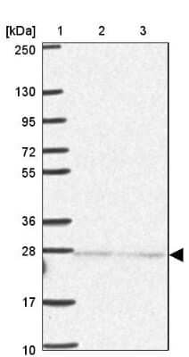 Western Blot: Importin alpha 5/KPNA1/SRP1 Antibody [NBP2-47418]