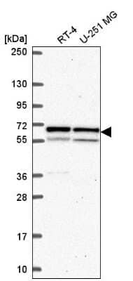 Western Blot: Importin alpha 5/KPNA1/SRP1 Antibody [NBP2-56022]