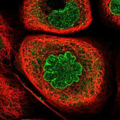 Immunocytochemistry/ Immunofluorescence: Importin beta/KPNB1 Antibody [NBP2-55641]