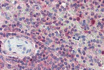 Immunohistochemistry-Paraffin: Importin beta/KPNB1 Antibody [NB100-40784]
