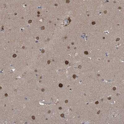 Immunohistochemistry-Paraffin: Importin beta/KPNB1 Antibody [NBP1-87712]