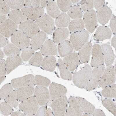 Immunohistochemistry-Paraffin: Importin beta/KPNB1 Antibody [NBP1-87712]