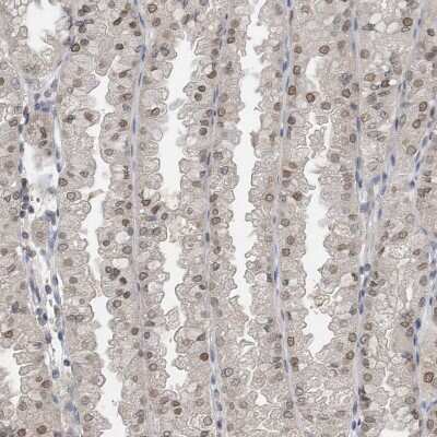 Immunohistochemistry-Paraffin: Importin beta/KPNB1 Antibody [NBP1-87712]