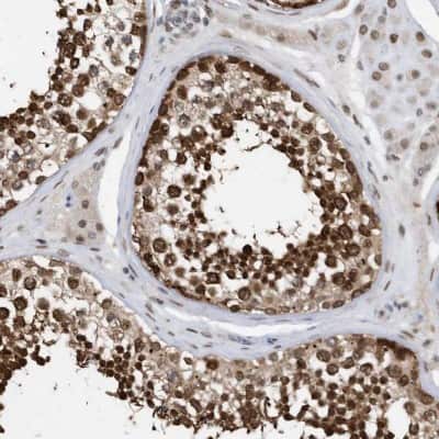 Immunohistochemistry-Paraffin: Importin beta/KPNB1 Antibody [NBP1-87712]