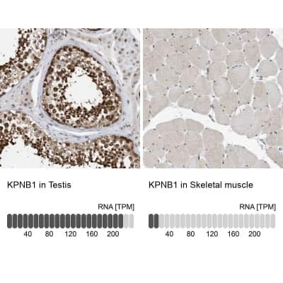 Immunohistochemistry-Paraffin: Importin beta/KPNB1 Antibody [NBP1-87712]