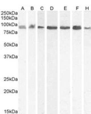 Western Blot: Importin beta/KPNB1 Antibody [NB100-40784]