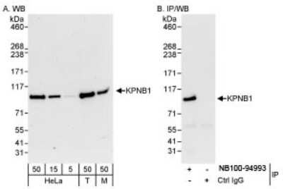 Western Blot: Importin beta/KPNB1 Antibody [NB100-94993]