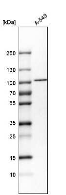 Western Blot: Importin beta/KPNB1 Antibody [NBP1-87712]