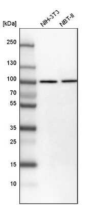 Western Blot: Importin beta/KPNB1 Antibody [NBP1-87712]