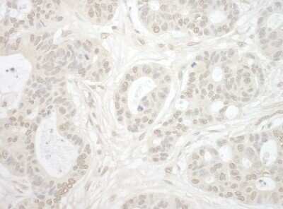 Immunohistochemistry-Paraffin: Importin4 Antibody [NBP1-46165]