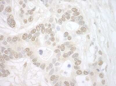 Immunohistochemistry: Importin4 Antibody [NBP1-46166]