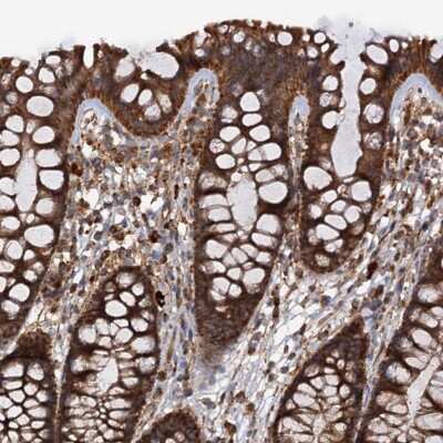 Immunohistochemistry-Paraffin: Importin4 Antibody [NBP1-89841]