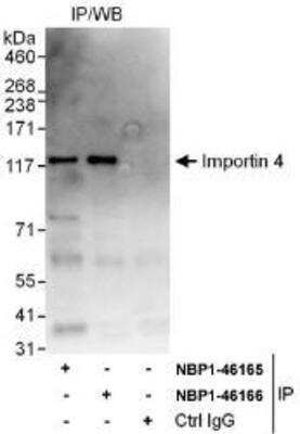 Immunoprecipitation: Importin4 Antibody [NBP1-46165]