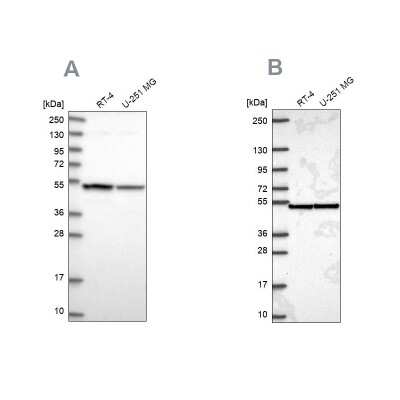 Western Blot: Importin4 Antibody [NBP1-89841]