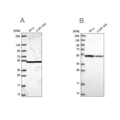 Western Blot: Importin4 Antibody [NBP2-56986]