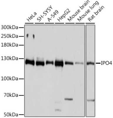 Western Blot: Importin4 AntibodyAzide and BSA Free [NBP3-03794]