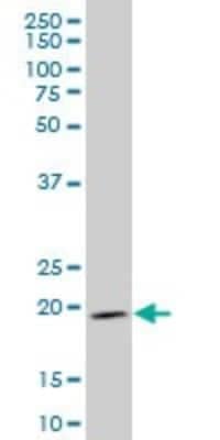 Western Blot: Indian Hedgehog/Ihh Antibody (2G9) [H00003549-M01]